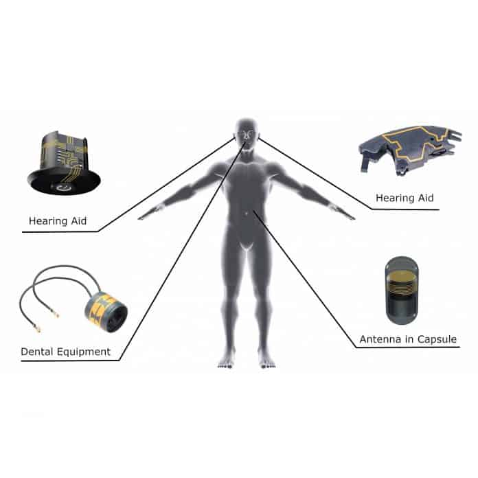 3D-MID technology makes it possible to make high-tech sensors that can be inserted inside the patient's body